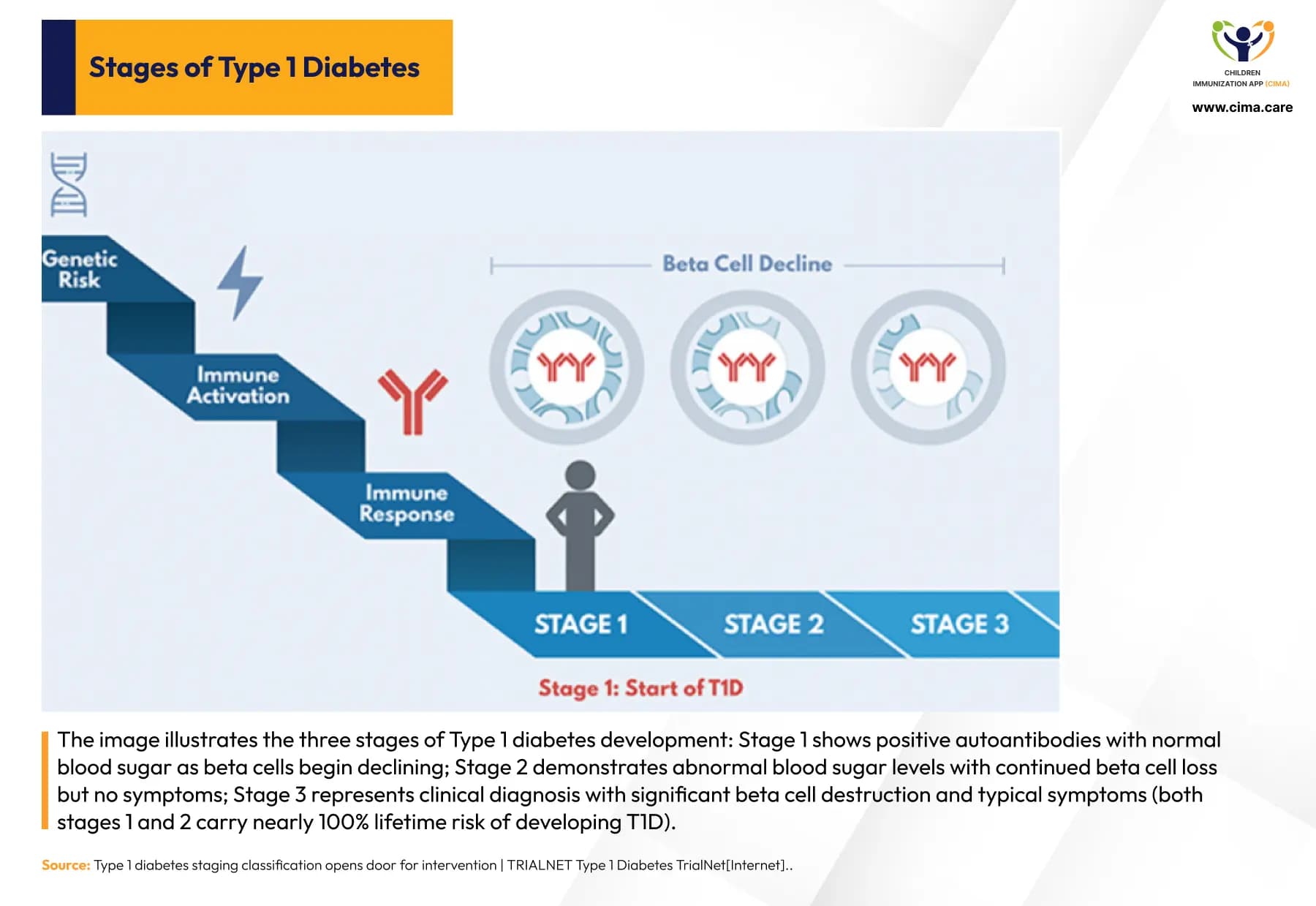 Infographic showing T1D stages with beta cell decline from the first stage to diagnosis.